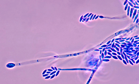 Fusarium sp dan T-2 Toxin