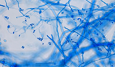 Fusarium sp